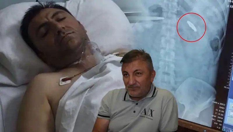 15 Temmuz’un Gizli Yaraları: Vücudunda Kurşunla Taşıdığı 9 Yıllık Acı
