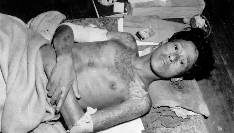 80 Yıl Sonra Nagasaki'den Gelen Korkutucu Uyarı: Nükleer Felaket Penceresi Açılıyor